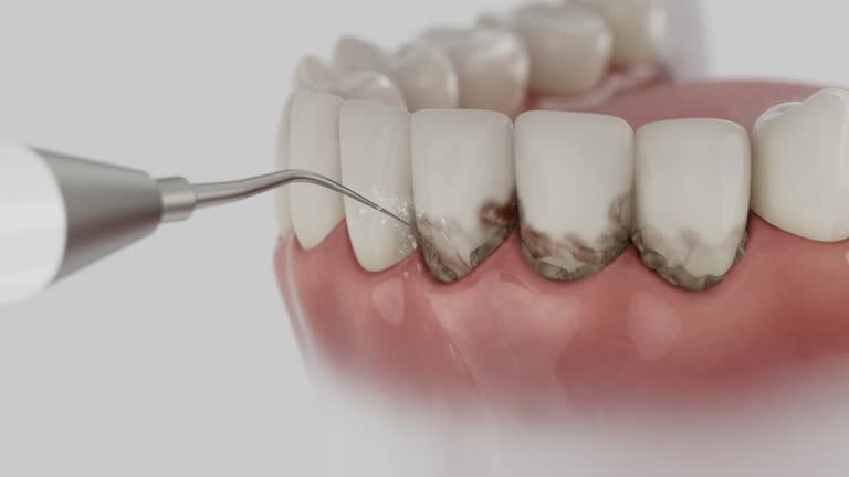 Trusted Emergency Dentist service in Casper, WY - Dentist Open Now